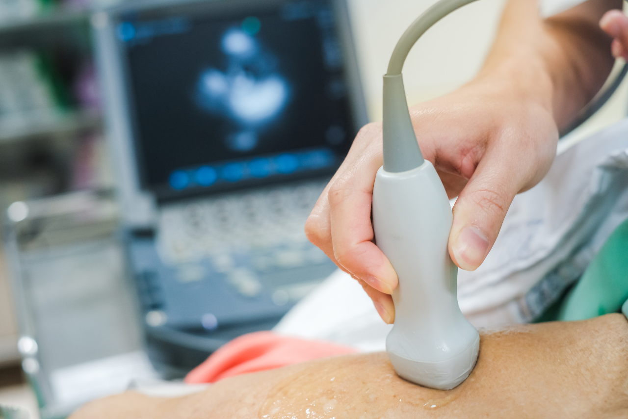 Exame de ecocardiograma sendo realizado na Clínica IMOI, com aparelho de ultrassom